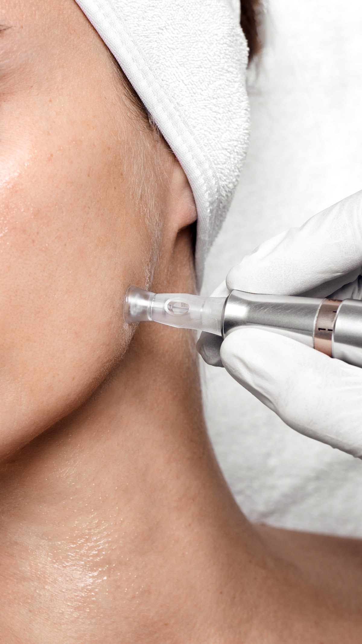 Serums ar pipeti procedūras laikā